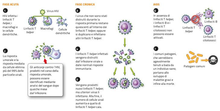 decorso_HIV